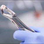 A Life Reshaped by Modern Dental Solutions in Gujarat