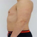 Mounjaro Malaysia: Safe Weight Management with MOH-Approved Care