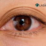 Eye Surgery: Pterygium Removal – Safe, Expert Care