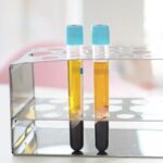 Chemical Peels London | Thecheclinic.co.uk