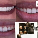 أفضل طبيب أسنان أطفال في بنها لعناية مميزة وابتسامة صحية