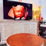 Find 3D/4D Baby Ultrasound Near Me – Premium HD Imaging