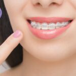 Pròtesis Dental Gines: solucions naturals i duradores | Clinicadentalcristinamora